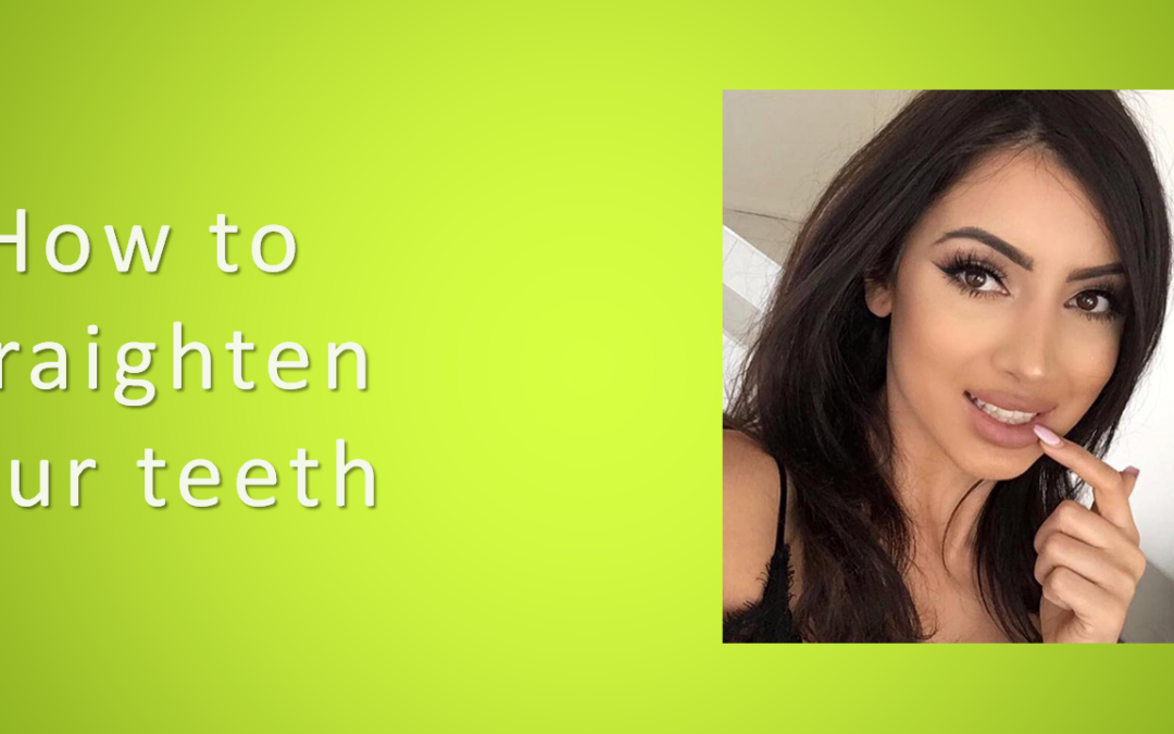 How to straighten teeth – what you need to know