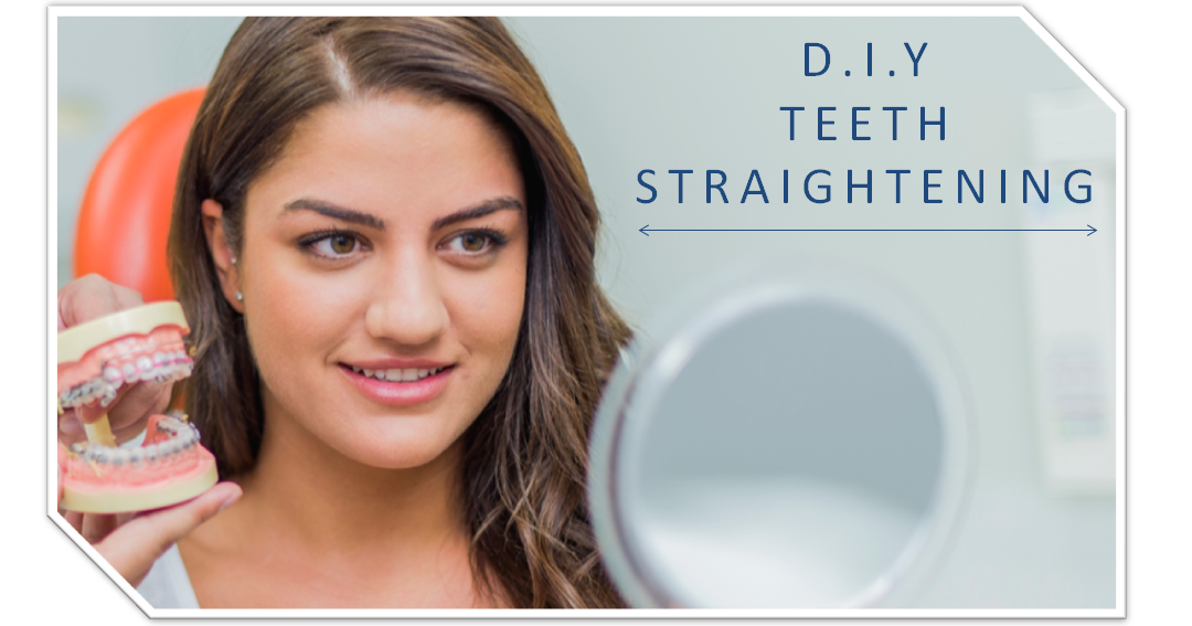 Risks of DIY Teeth Straightening