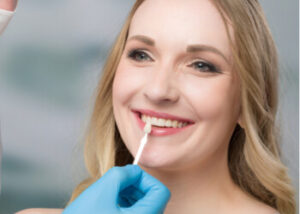 dental veneers thailand in Winston Hills