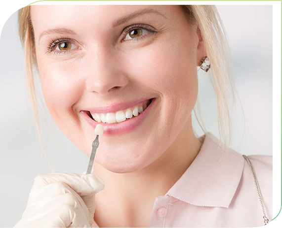 Dental veneers