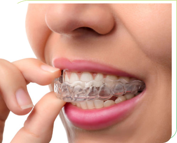 invisalign