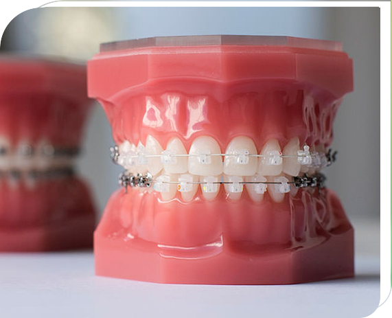 Magical deals teeth brace