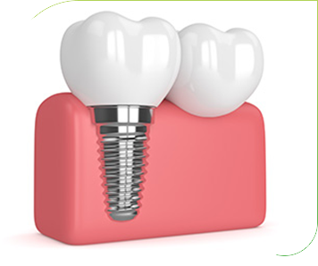 dental implants winston hills