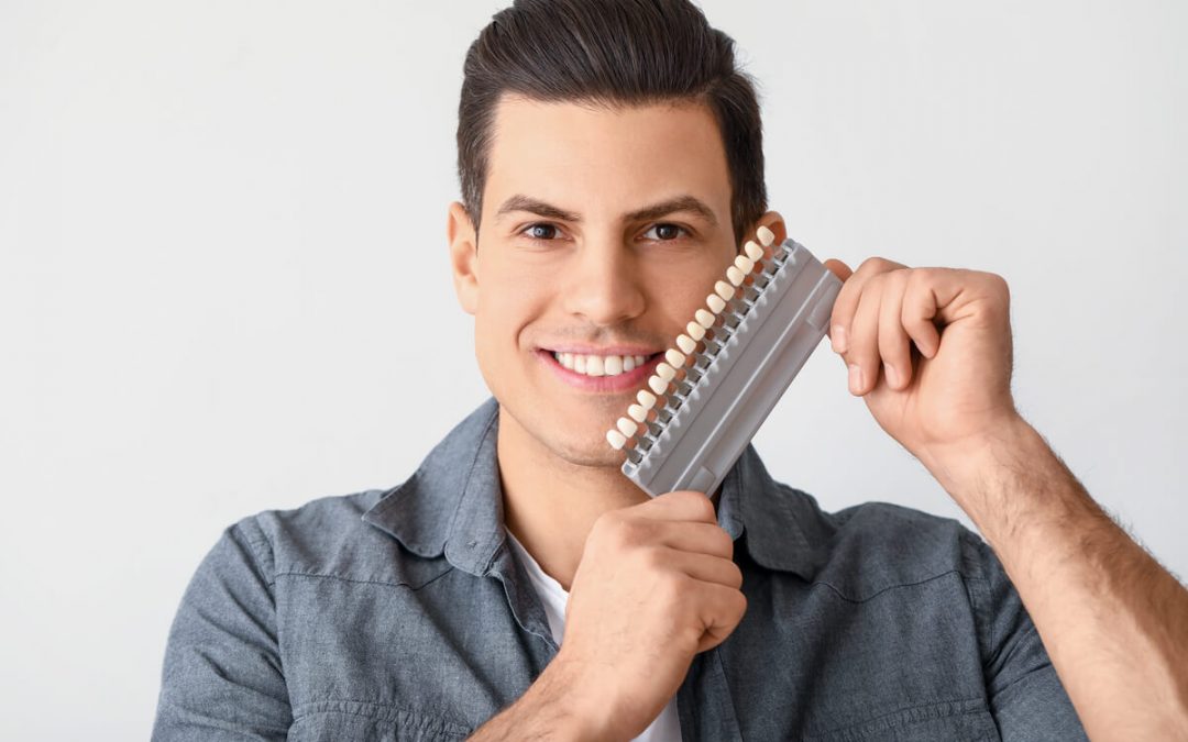 Dental Veneers Cost Explained — Planning Your Budget