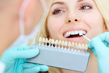 How Much Do Veneers Cost in Australia crown colour winston hills