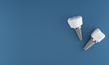 tooth implant in bali winston hills