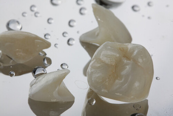 natural-looking-veneers application shells