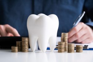 What Are Veneers made of cost