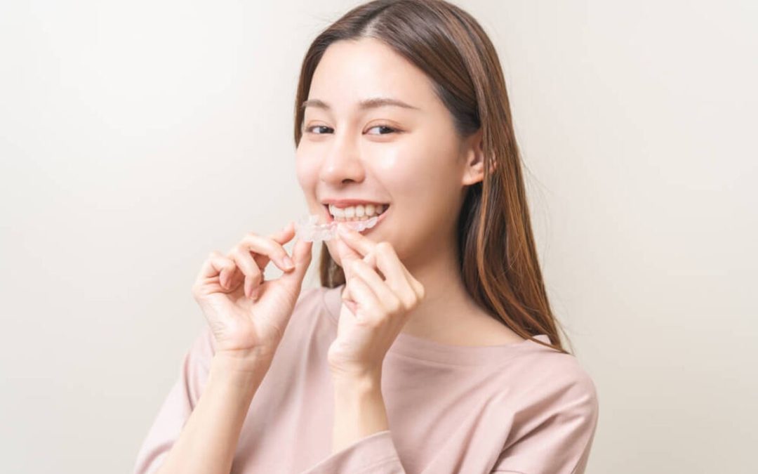 How Much Does Invisalign Cost? Everything You Need to Know Before You Begin