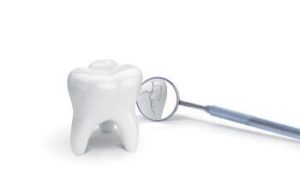 Tooth Sensitivity After a Filling crack