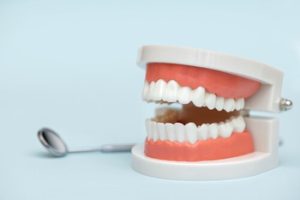 Dental Bridge Types wear