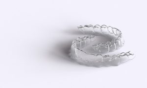 What Is Invisalign set