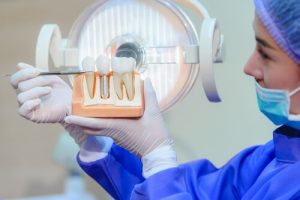 Dental Bone Graft Recovery components